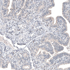 Anti-FOXL2 Antibody