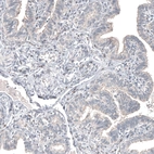 Immunohistochemical staining of human fallopian tube shows weak to moderate nuclear positivity in stromal cells.