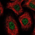 Immunofluorescent staining of human cell line A549 shows localization to nucleoplasm.