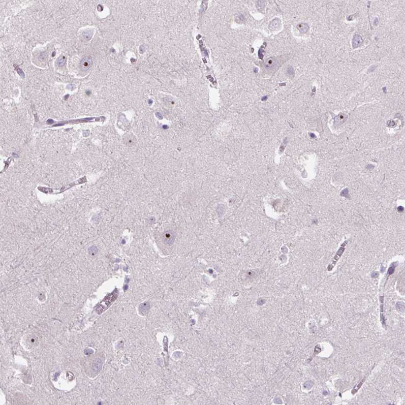 Anti-TMEM151B Antibody