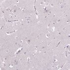 Anti-TMEM151B Antibody