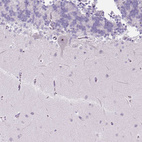 Immunohistochemical staining of human cerebellum shows moderate positivity in nucleoli in Purkinje cells.