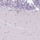 Immunohistochemical staining of human cerebellum shows moderate positivity in nucleoli in Purkinje cells.