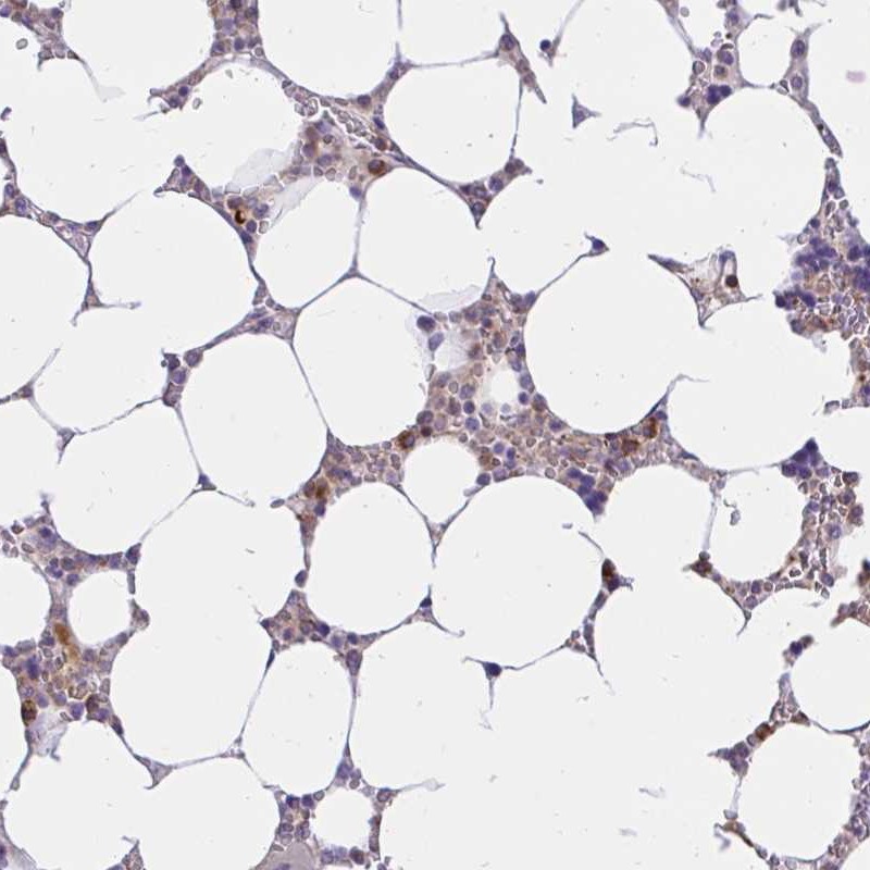 Anti-ABCB10 Antibody