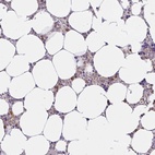 Anti-ABCB10 Antibody