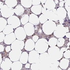 Anti-ABCB10 Antibody