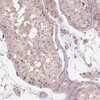 Immunohistochemical staining of human testis shows moderate positivity in nucleoli in cells in seminiferous ducts.