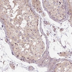 Immunohistochemical staining of human testis shows moderate positivity in nucleoli in cells in seminiferous ducts.