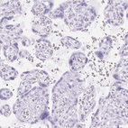 Immunohistochemical staining of human placenta shows no positivity in trophoblastic cells as expected.