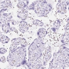 Immunohistochemical staining of human placenta shows no positivity in trophoblastic cells as expected.
