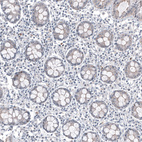 Immunohistochemical staining of human rectum shows no positivity in glandular cells as expected.