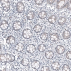 Immunohistochemical staining of human rectum shows no positivity in glandular cells as expected.
