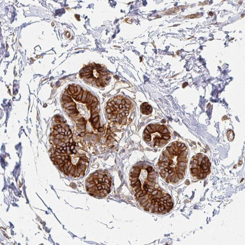 Anti-ARHGAP35 Antibody