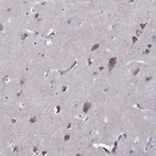 Immunohistochemical staining of human cerebral cortex moderate cytoplasmic positivity in neurons.