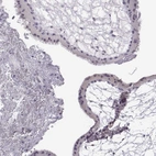 Immunohistochemical staining of human placenta shows no positivity in trophoblastic cells as expected.