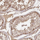 Immunohistochemical staining of human testis shows moderate membranous and cytoplasmic positivity in cells in seminiferous ducts.