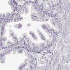 Immunohistochemical staining of human prostate shows no positivity in glandular cells as expected.