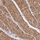 Immunohistochemical staining of human heart muscle shows strong cytoplasmic positivity in cardiomyocytes.