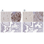 Immunohistochemical staining of human hypothalamus, pituitary gland, placenta and prostate using Anti-VGF antibody HPA055177 (A) shows similar protein distribution across tissues to independent antibody HPA072505 (B).
