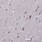 Immunohistochemical staining of human cerebral cortex moderate cytoplasmic positivity in neurons.