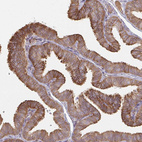Immunohistochemical staining of human fallopian tube shows strong membranous positivity in glandular cells.