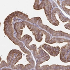 Immunohistochemical staining of human fallopian tube shows strong membranous positivity in glandular cells.