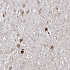 Anti-VGF Antibody