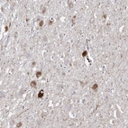 Immunohistochemical staining of human hypothalamus shows strong positivity in a subset of neurons.