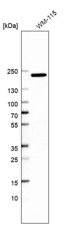 Western blot analysis in human cell line WM-115.