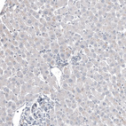 Immunohistochemical staining of human liver shows no positivity in hepatocytes as expected.