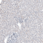 Anti-FOXL2 Antibody