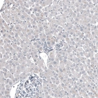 Immunohistochemical staining of human liver shows no positivity in hepatocytes as expected.