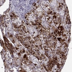 Immunohistochemical staining of human pituitary gland shows strong positivity in anterior cells.
