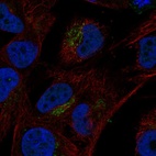 Immunofluorescent staining of human cell line SK-MEL-30 shows localization to the Golgi apparatus.