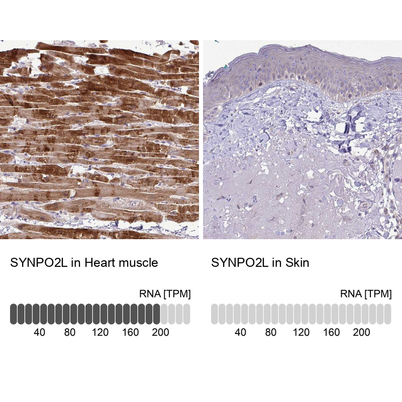 Anti-SYNPO2L Antibody