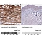 Anti-SYNPO2L Antibody