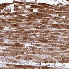 Immunohistochemical staining of human heart muscle shows strong cytoplasmic positivity in cardiomyocytes.