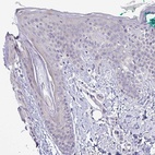 Immunohistochemical staining of human skin shows low expression as expected.