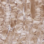 Immunohistochemical staining of human skeletal muscle shows moderate cytoplasmic positivity in myocytes.