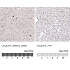 Anti-CALB2 Antibody