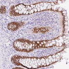 Anti-CDX1 Antibody