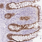 Immunohistochemical staining of human rectum shows high expression.