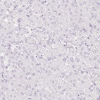 Anti-CDX1 Antibody