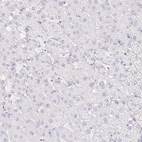 Immunohistochemical staining of human liver shows low expression as expected.