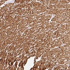 Anti-BBIP1 Antibody