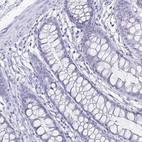 Immunohistochemical staining of human colon shows no positivity in glandular cells as expected.