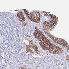 Immunohistochemical staining of human gallbladder shows strong membranous positivity in glandular cells.