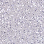 Immunohistochemical staining of human liver shows no positivity in hepatocytes as expected.