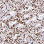 Immunohistochemical staining of human stomach shows strong membranous positivity in glandular cells.
