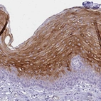 Immunohistochemical staining of human esophagus shows moderate to strong cytoplasmic positivity in squamous epithelial cells.